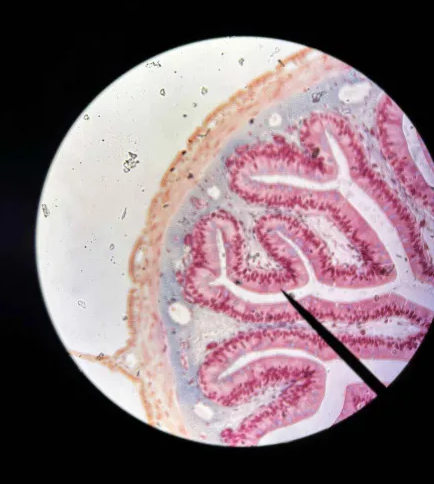 <p>Where is this tissue from?</p>