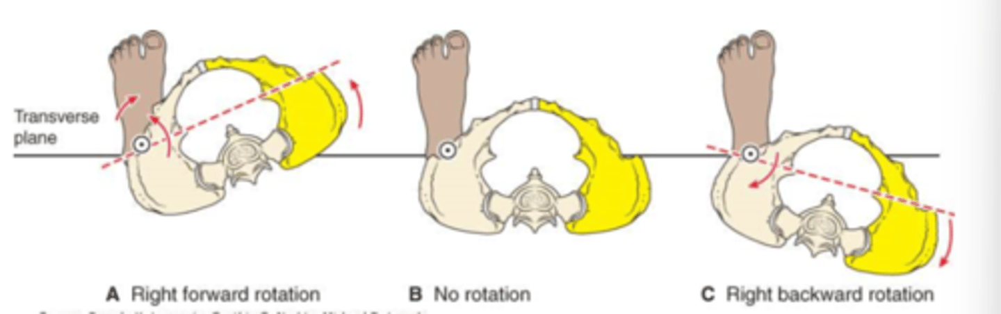 <p>transverse plane motion of the pelvis around one supporting limb</p><p>*named according to motion of opposite side from supporting limb</p>