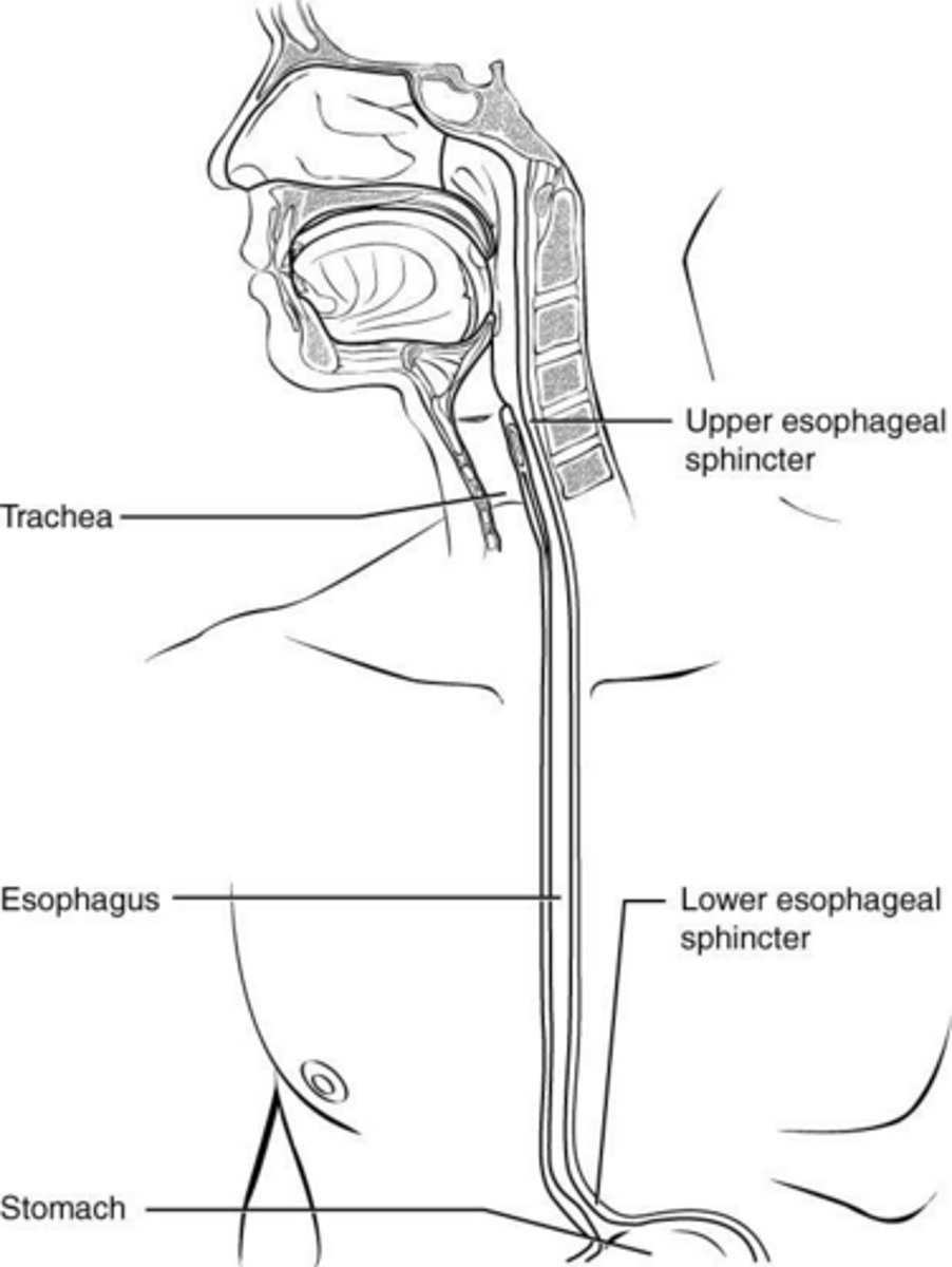 <p>Lower esophageal sphincter (LES) relaxation and pressure allowing stomach acid to rise.</p>