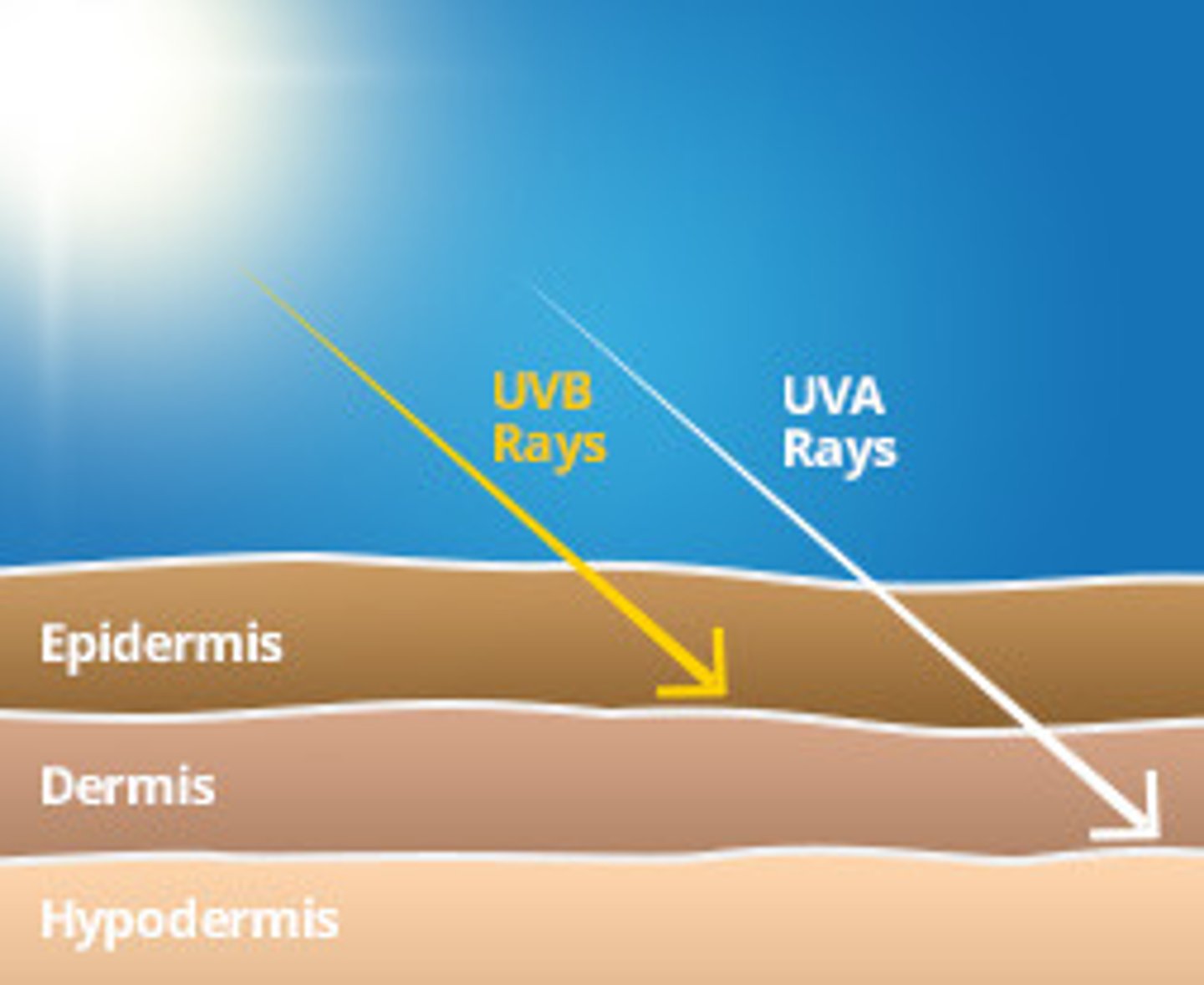<p>- UV radiation (UVR): UVB</p><p>- cytotoxic drugs emitting radiation (eg. Polonium => never used therapeutically due to toxicity)</p>
