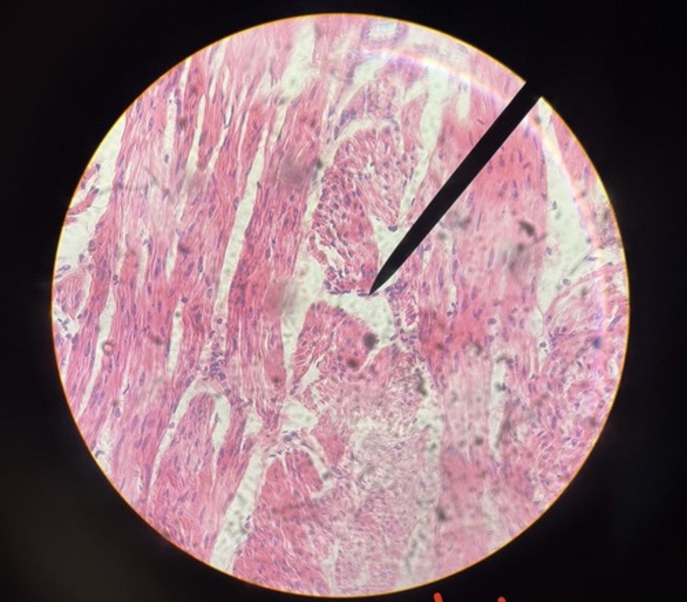 <p>What type of muscle is this?</p>