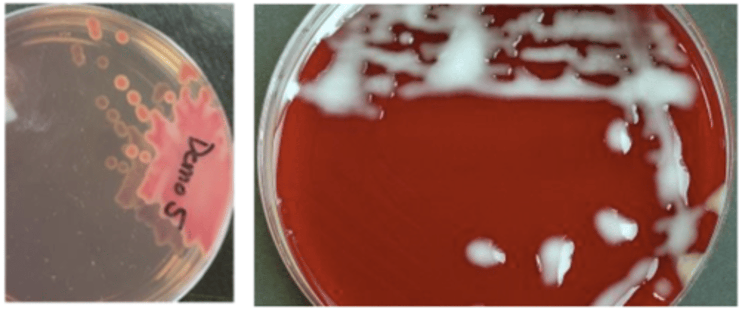 <p>A and MAC cultures of a uterine sample from a mare which developed metritis following natural breeding.</p><p>The isolate is an oxidase-negative gram-negative bacillus. What is your presumptive identification? What are other bacterial causes of equine metritis?</p>