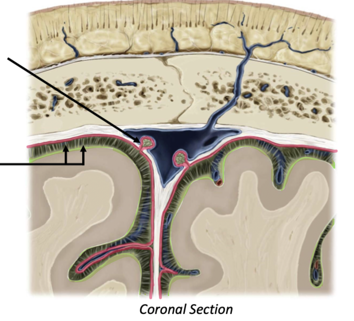 <p>Arachnoid Mater</p>