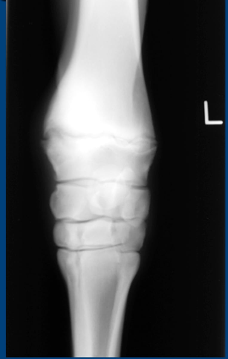 <p>Enlargement of the growth plates of certain long bones</p><p>Affects young, rapidly growing foals (4-8 mo. old)</p><p>Unknown cause</p><p>Signs: Enlargement of distal radius, tibia, and 3rd metacarpal/tarsal</p><p>TX: Change foal's ration, limit exercise, NSAIDs</p>