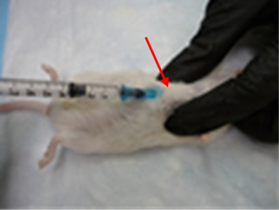 <p>Heart-Intercardiac (IC)</p>