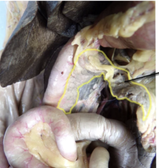 <p>yellow line inside</p>