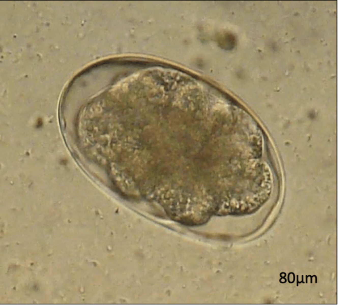 <p>What egg does this parasite belong to?</p>