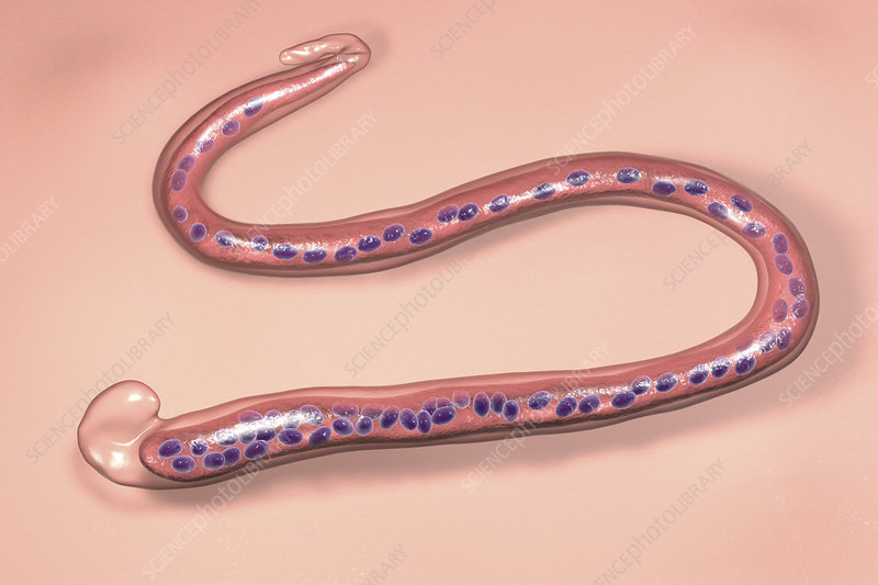 <p>Wuchereria (Filaria worm)</p>