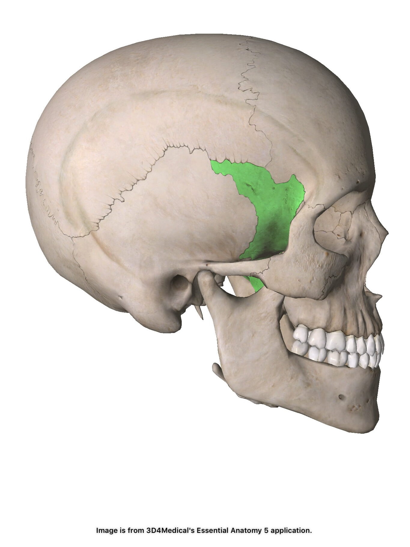 <p>Kilbenet. Oparig. Neurokraniet.</p>