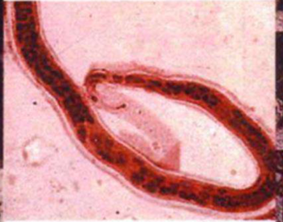 <p>Parasite under microscope </p>