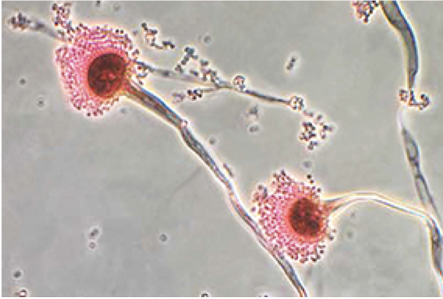 <p>Which fungus is transmitted by <strong>inhalation</strong> of <strong>dust soil and mold spores in the air</strong> and causes <strong>aspergillosis?</strong></p><ul><li><p>construction workers at higher risk</p></li></ul><ul><li><p><strong>produces mycotoxins → liver damage/liver cancer </strong></p></li><li><p>can <strong>disseminate</strong> from lung to GI, brain, other organs</p></li><li><p>symptoms range from allergic reaction to bloody cough and fatigue</p></li></ul>