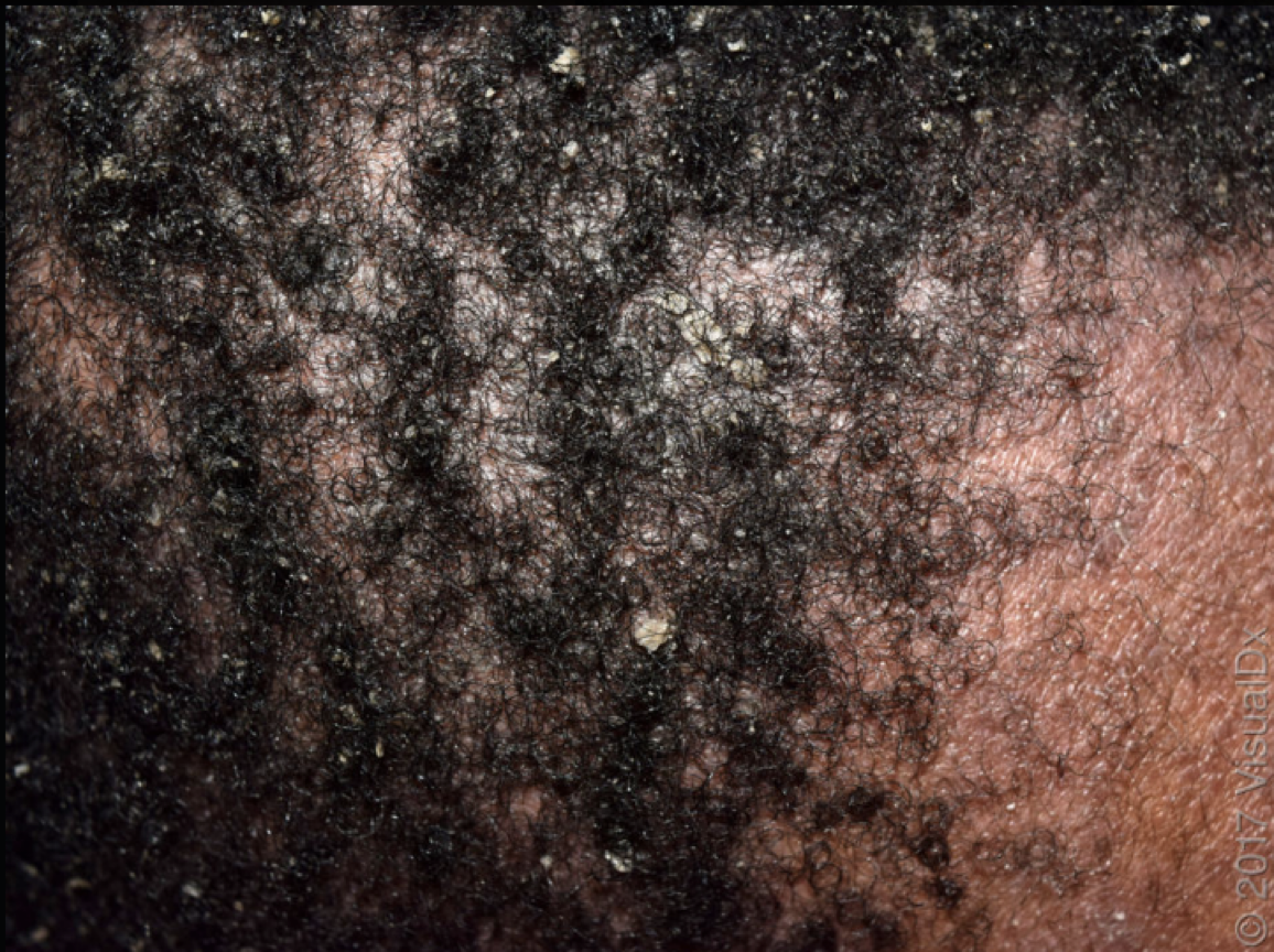 term image