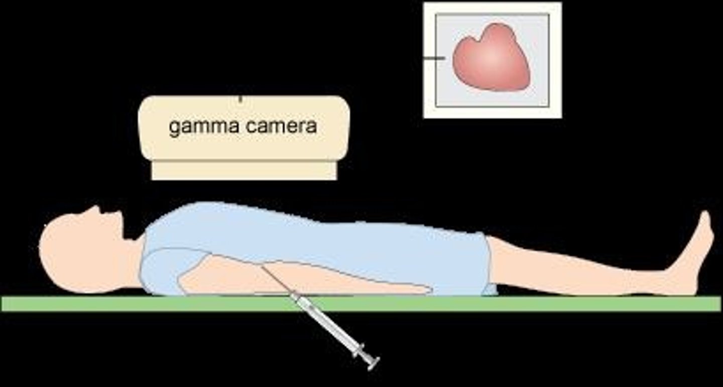 <p>A device used in nuclear medicine that detects gamma ray signals emitted by radionuclides taken up by organs, converting them into images.</p>
