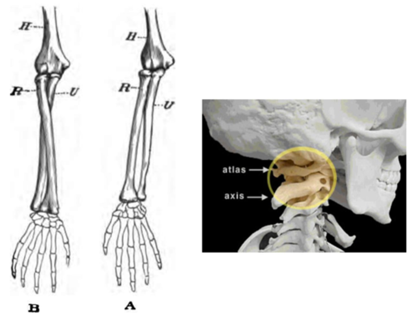 <p>What type of joint is this?</p>