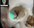 <p>forms lateral eye orbit</p>