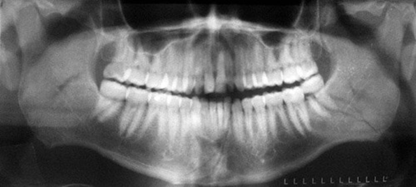 <p>to identify various issues including impacted teeth, jaw and sinus problems, cysts, tumors, and gum disease</p>