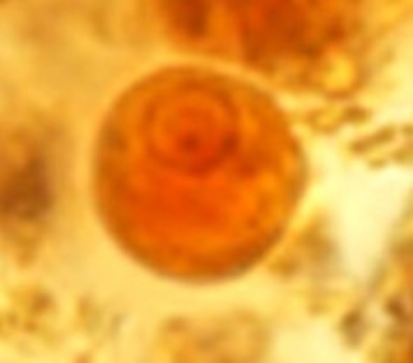 <p>Identify the parasite</p>