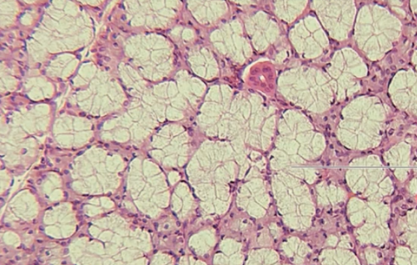 <p>what kind of gland is this</p>