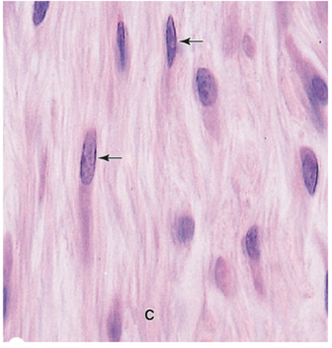 <p>Describe the nucleus of active fibroblasts.</p>