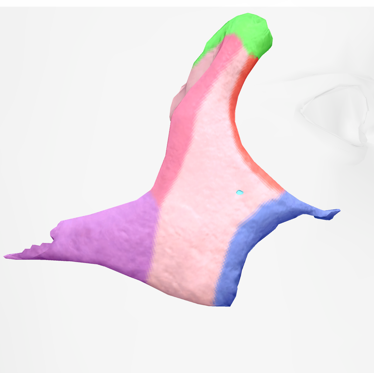 <p>little divot in cheek on zygomatic bone </p>