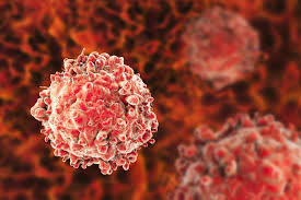 <p>Leukemias</p>