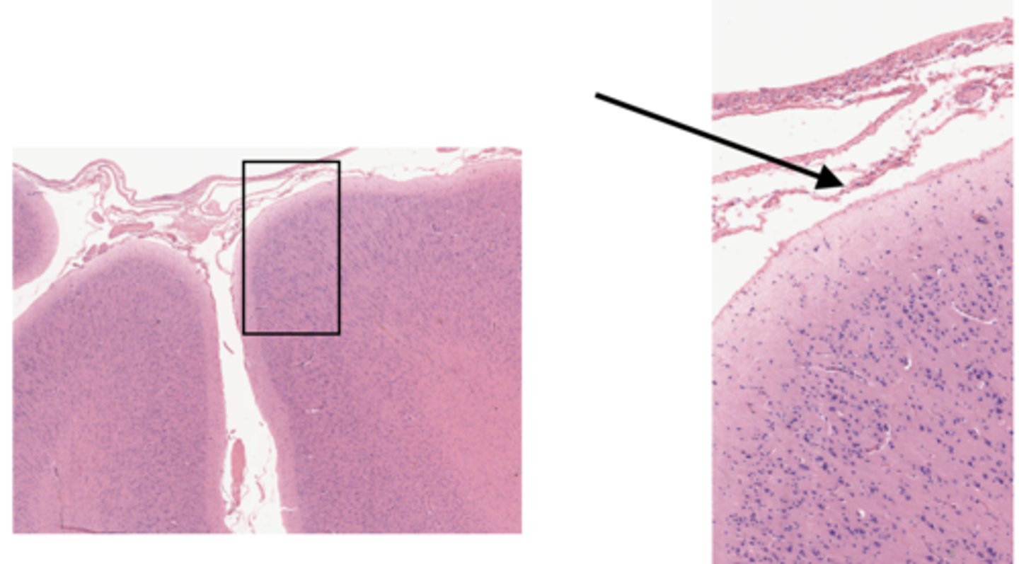 <p>Identify the layer of the cerebrum</p>