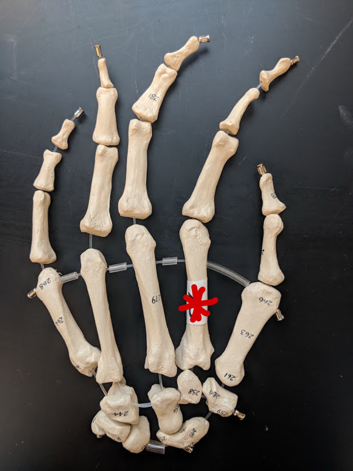 <p>Name this bone</p>