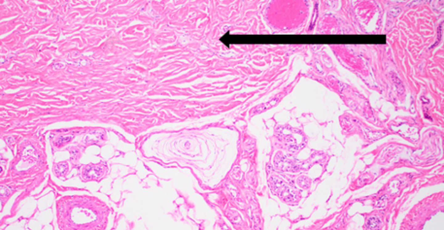 <p>name the tissue</p>