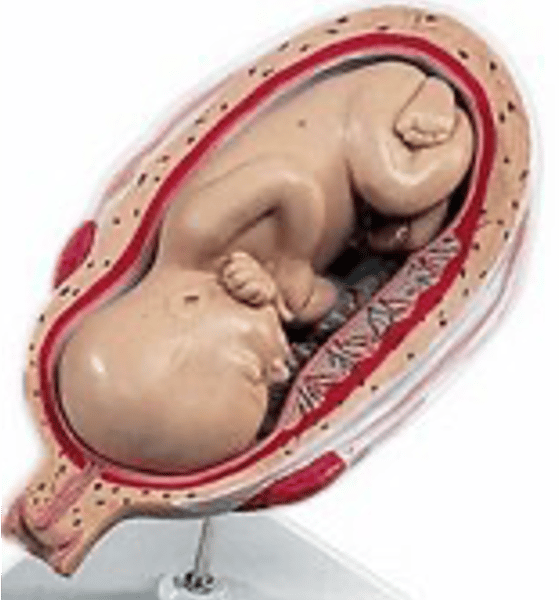 <p>Name the fetal presentation</p>