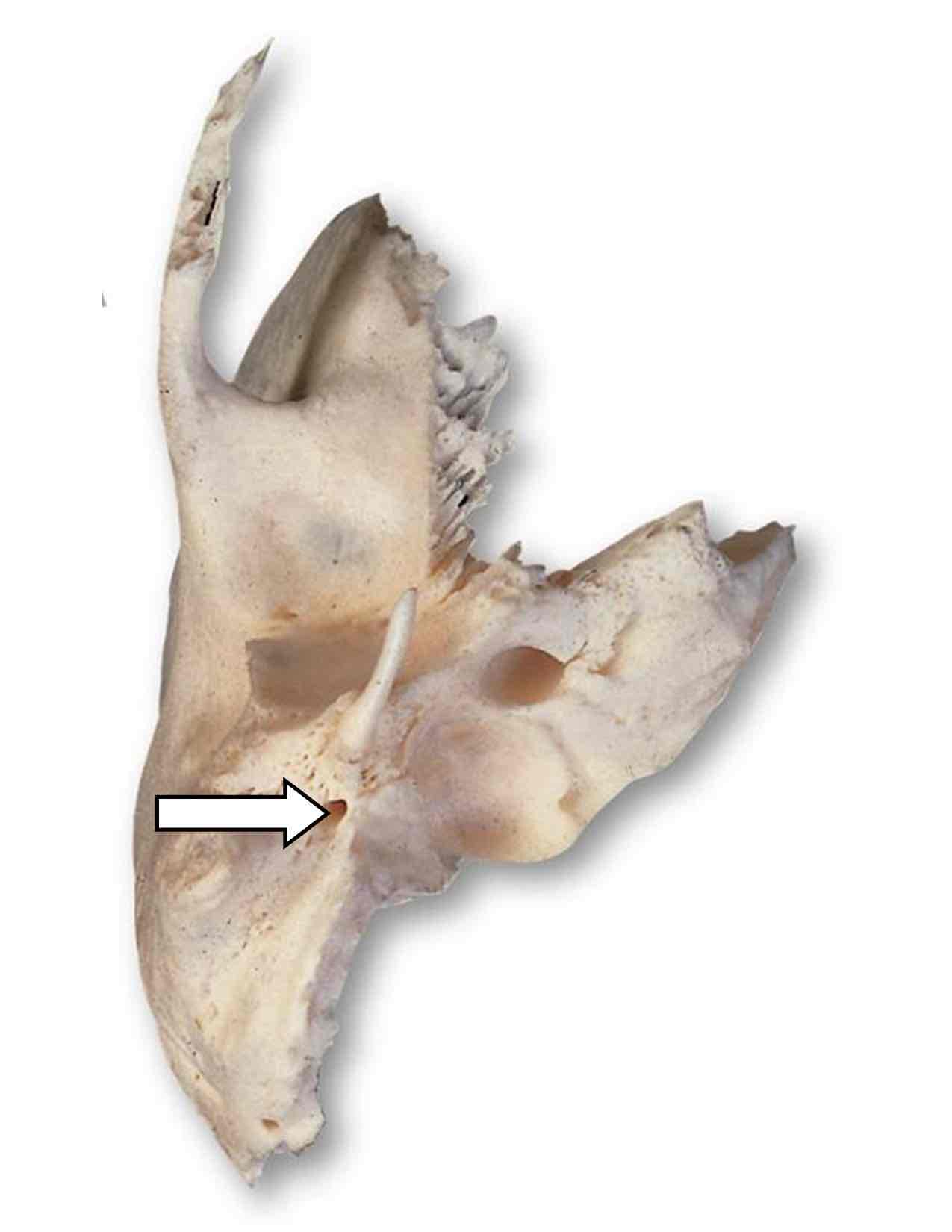 <p>Name one cranial nerve that passes through this hole, plus its roman numeral</p>