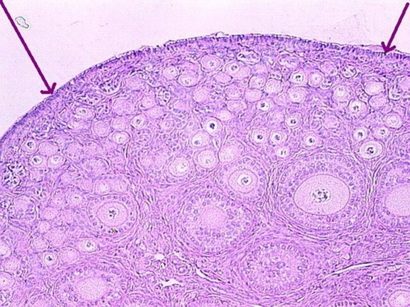 <p>Single outer layer</p>