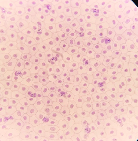 <p>Phylum?<br>subphylum?<br>Class?<br>order<br>Symmetry? Tissue type?<br>Cavity?</p>