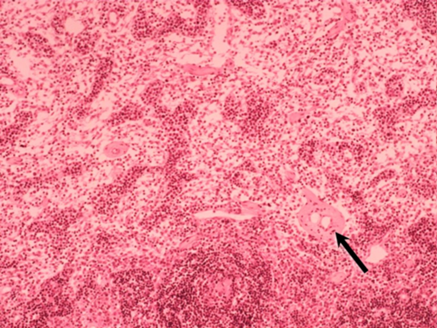 <p>black arrow</p><p>blood vessel</p>