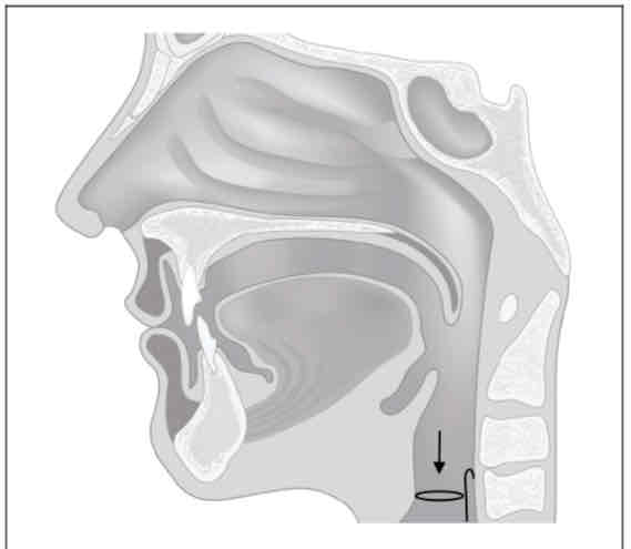 <p>What is the place of articulation? (Made in throat, between vocal folds)</p>