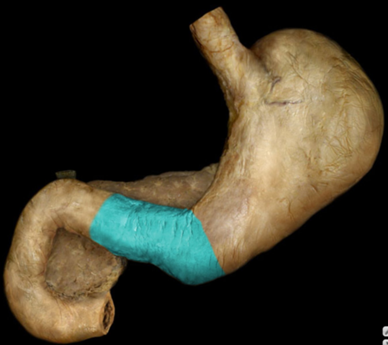 <p>The lower part of the stomach that connects to the small intestine.</p>