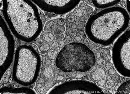 <p>focus a beam of electrons through a specimen, providing a cross-section of the specimen</p>