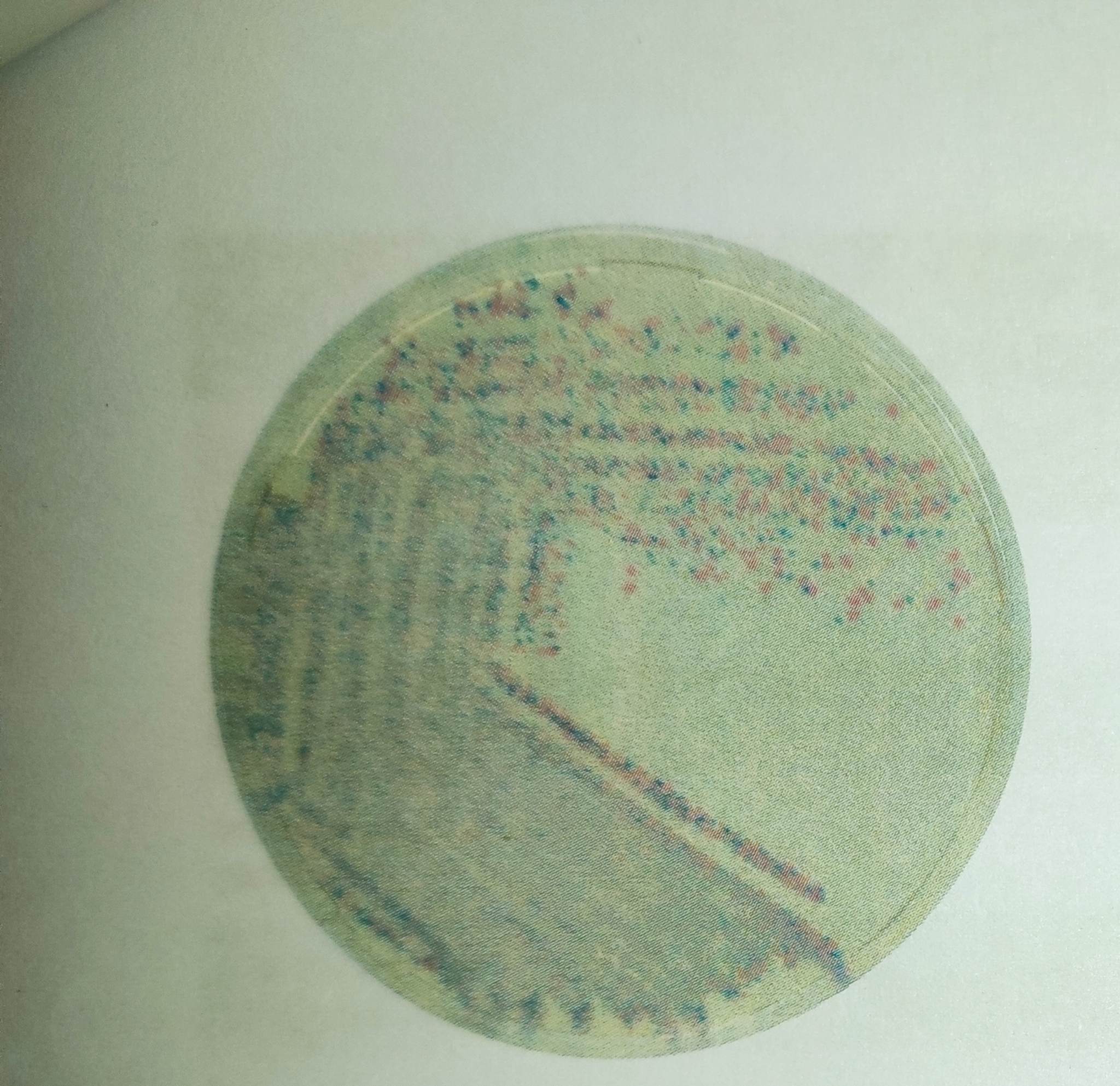 * identification of methicillin-resistant staphylococcus aureus