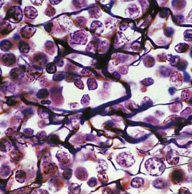 <p><strong>what is the connective tissue?</strong></p>