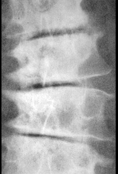 <p>what is seen here?</p>