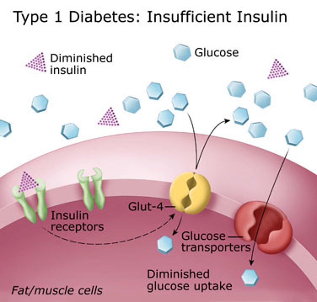 <p>No more insulin - glucose builds up - high blood pressure</p>