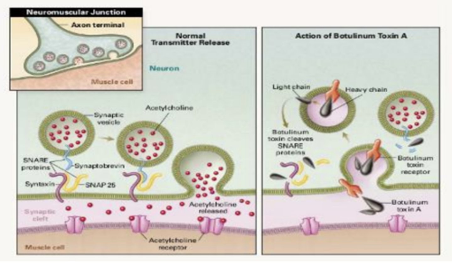 <p>• Toxin heavy chain binds to receptors on membrane of presynaptic neuron</p><p>• Toxin subunit enters neuron via endocytosis. Initially found only in new, empty vesicles</p><p>• Light chain of toxin escapes acetylcholine vesicles, enters cytoplasm and destroys SNARE complex. SNARE complex is necessary for vesicular release of acetylcholine, allowing toxin works as an indirect antagonist, by interfering with vesicular release of acetylcholine</p>