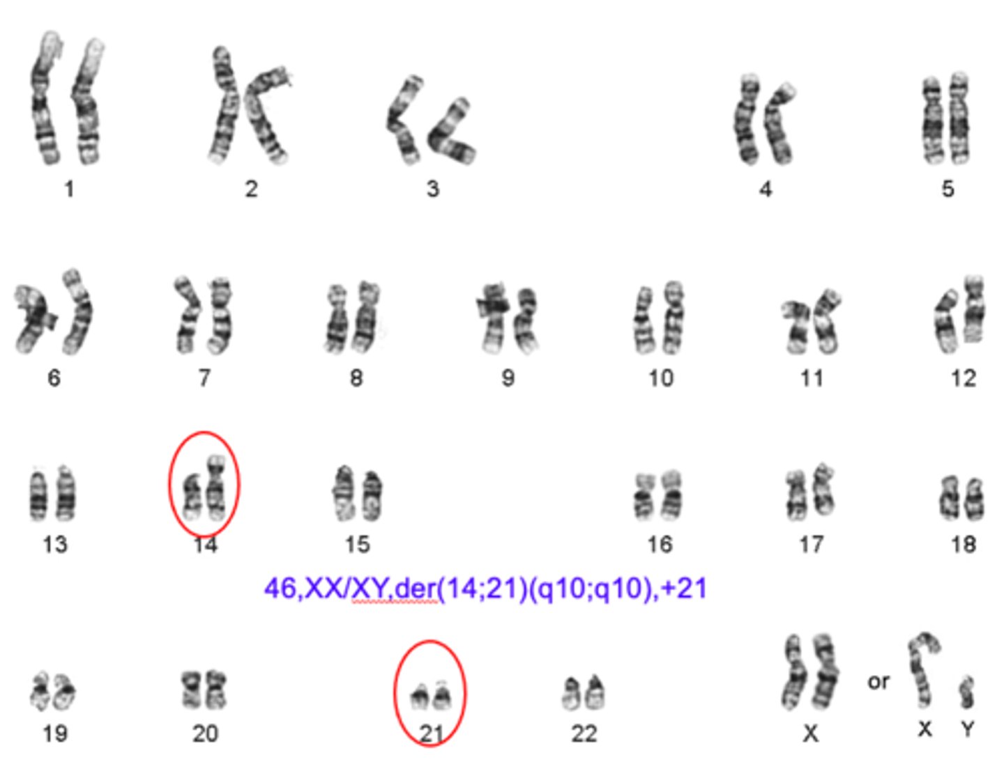 <p>based on the karyotype, identify the genetic disorder:</p>