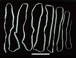 <p>Platyhelminthes</p><p>tape worm</p>