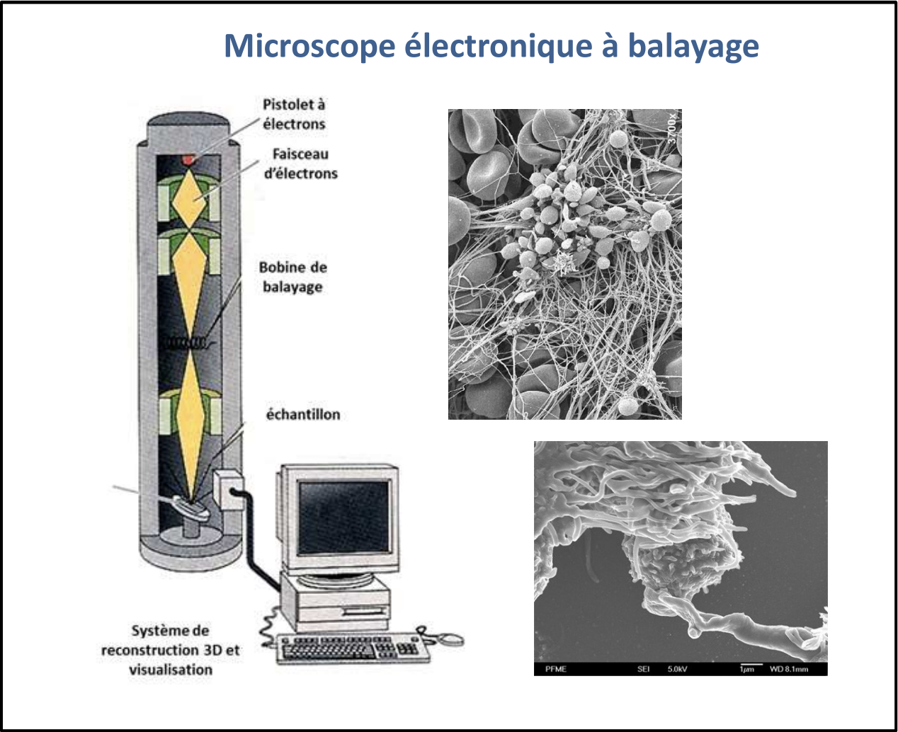 <p>La MEB repose sur un principe similaire, mais au lieu de traverser l’échantillon, le faisceau d’électrons balaie sa surface grâce à une bobine de balayage. Les électrons sont alors réfléchis en fonction de la nature et de la topographie de la surface rencontrée. Cela permet de reconstituer une image tridimensionnelle (3D) de la surface de l’échantillon, révélant son relief et ses contours avec une grande précision. Ce type de microscopie est particulièrement utilisé pour l’observation de surfaces externes, comme les membranes cellulaires, les bactéries ou les virus. L’échantillon est souvent recouvert d’une fine couche d’atomes lourds (comme l’or ou le platine) afin de faciliter la réflexion des électrons et d’augmenter le contraste de l’image</p>