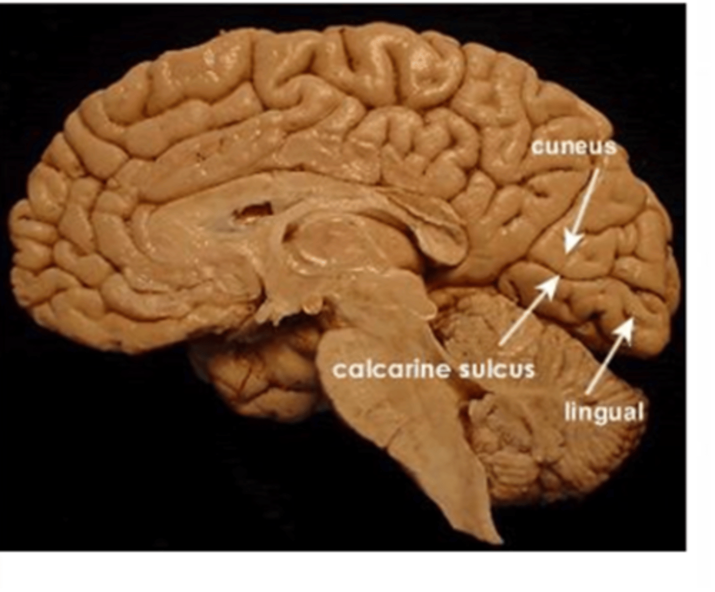 <p>Lingual gyrus</p>