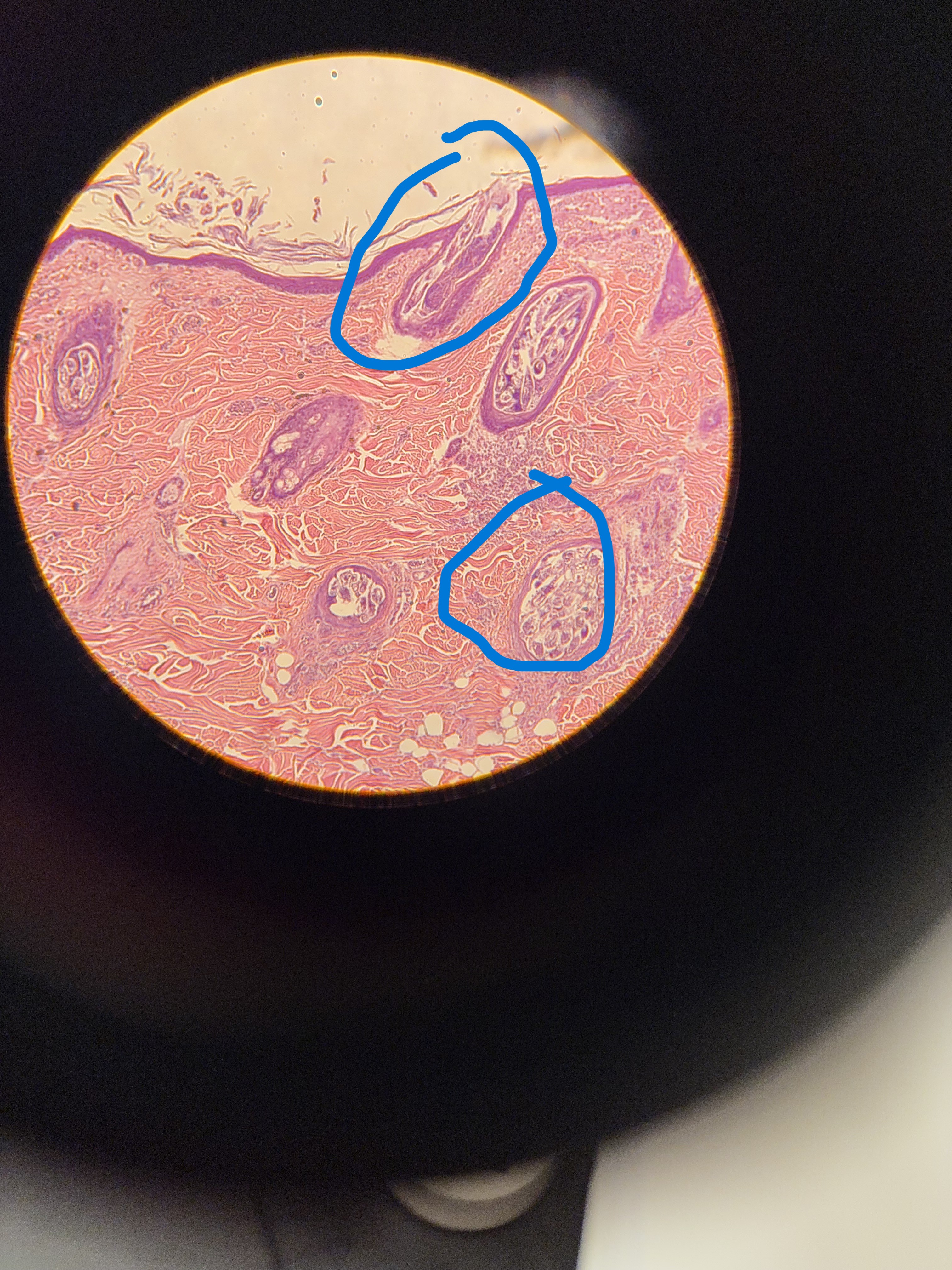 <p><br>name phylum, sub phylum, class and order for the animal circled</p><p><br> </p>