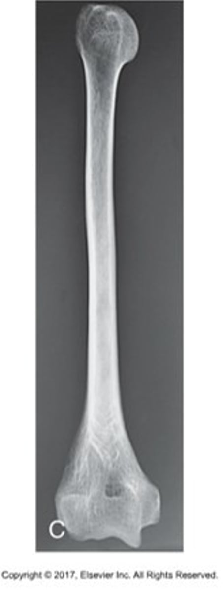 <p>Image appears longer than actual object due to angled CR.</p>