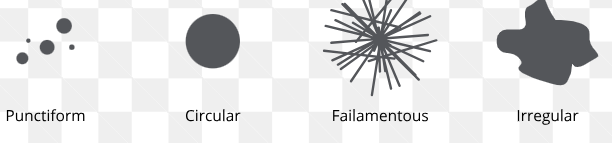 <p>Round (circular); Irregular; Punctiform (tiny pinpoint)</p>