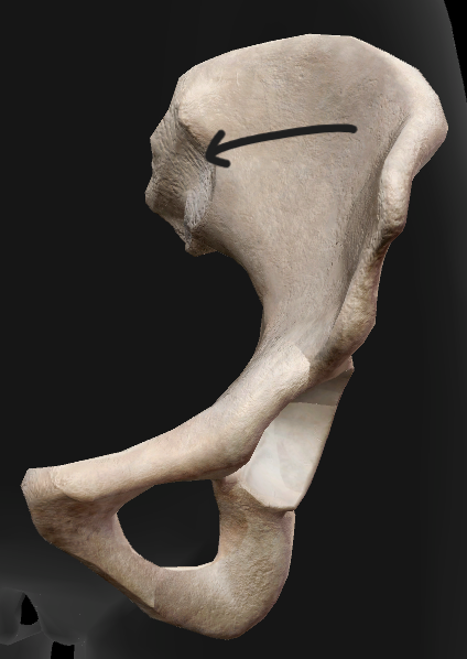 term image