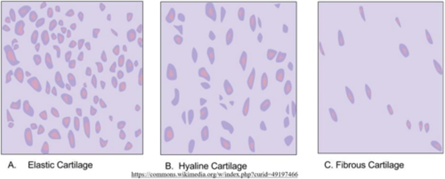 <p>hyaline; fibrous; elastic</p>
